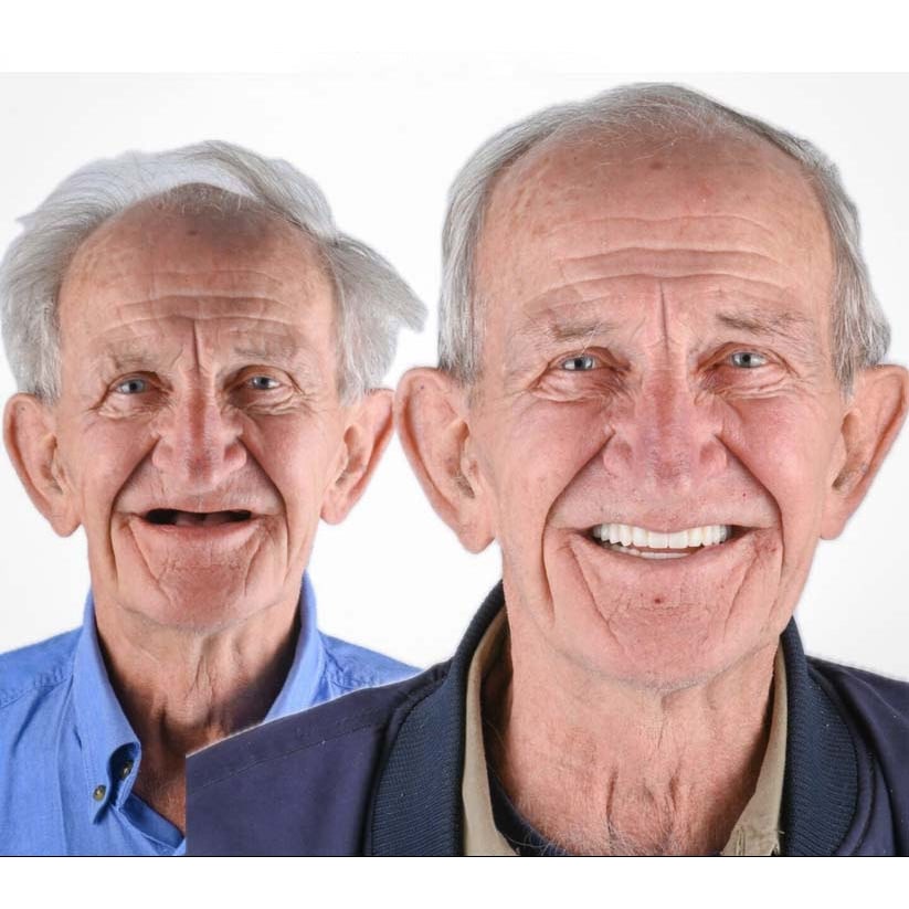 Affordable Removable Dentures with Flexible Cushion Grip Full Arch Set Cleaning