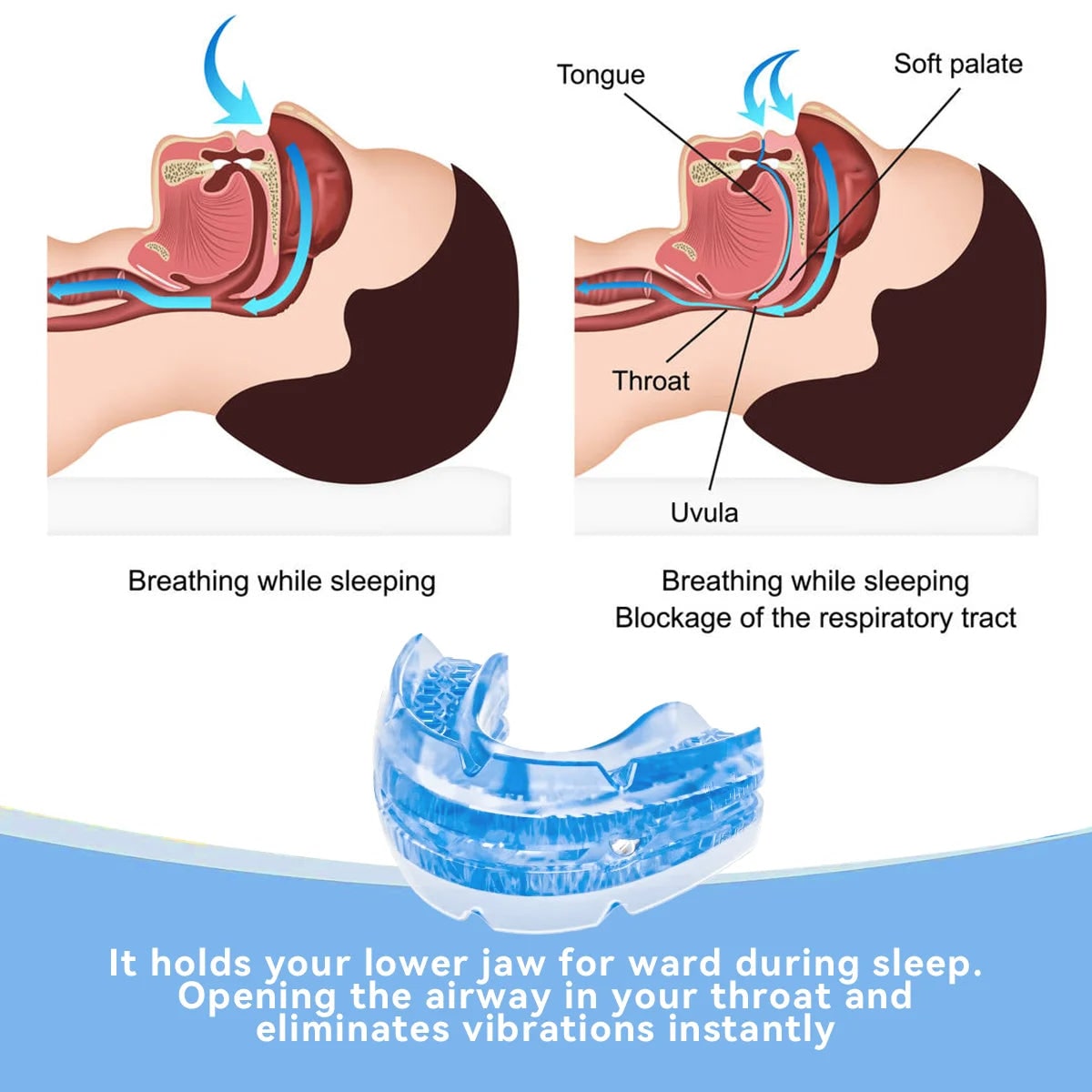 Adjustable Anti Snoring Mouthpiece Mouth Guard with Screwdriver and Storage Case Aid