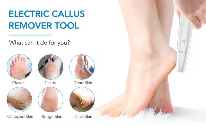 Electric Foot File and Callus Remover with Rechargeable Battery and Rotating Exfoliating Roller