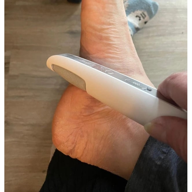 Electric Foot File and Callus Remover with Rechargeable Battery and Rotating Exfoliating Roller