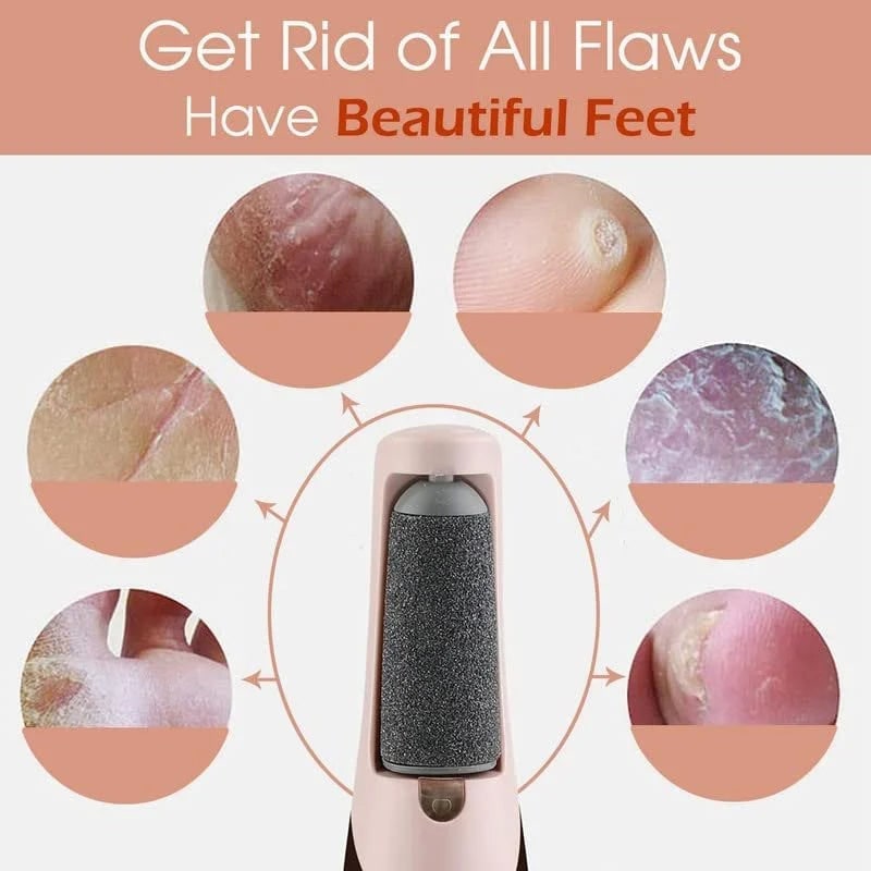 Electric Foot File and Callus Remover with Rechargeable Battery and Rotating Exfoliating Roller